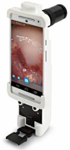 Mobile ODT device