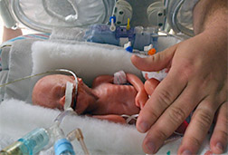SMART Diaphragm is a wireless early-detection device to reduce the global incidence of preterm birth