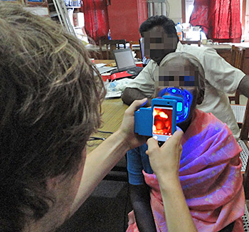Woman being examined for oral cancer with OScan device